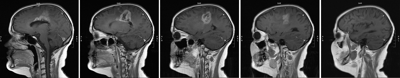 side view May 2007 series